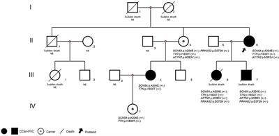 Case Report: Family Curse: An SCN5A Mutation, c.611C>A, p.A204E Associated With a Family History of Dilated Cardiomyopathy and Arrhythmia